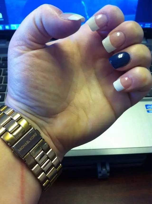 All About Nails