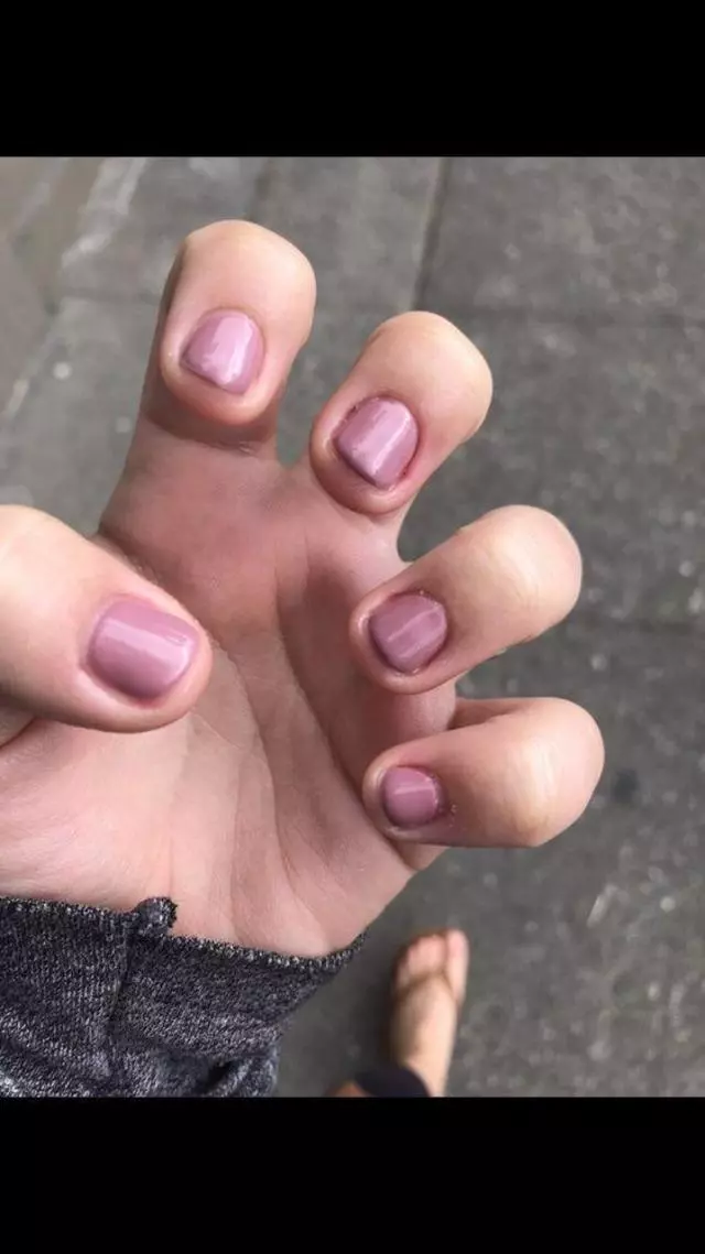 A Nail Today