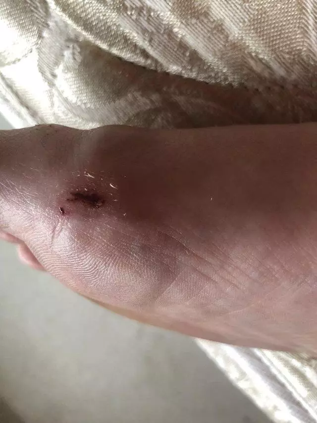 A Nail Today