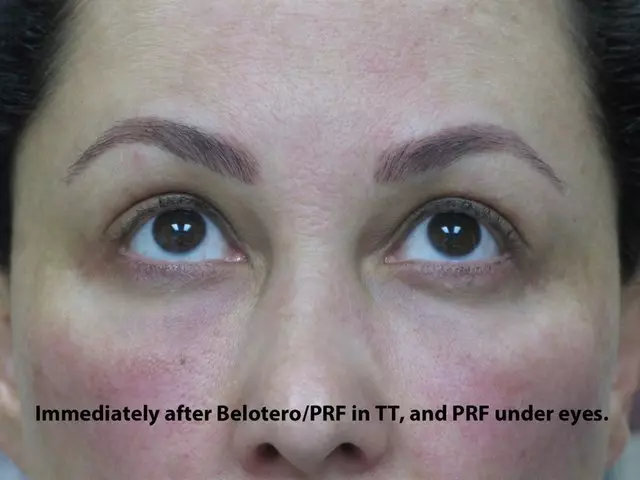 Aesthetic Laser Center
