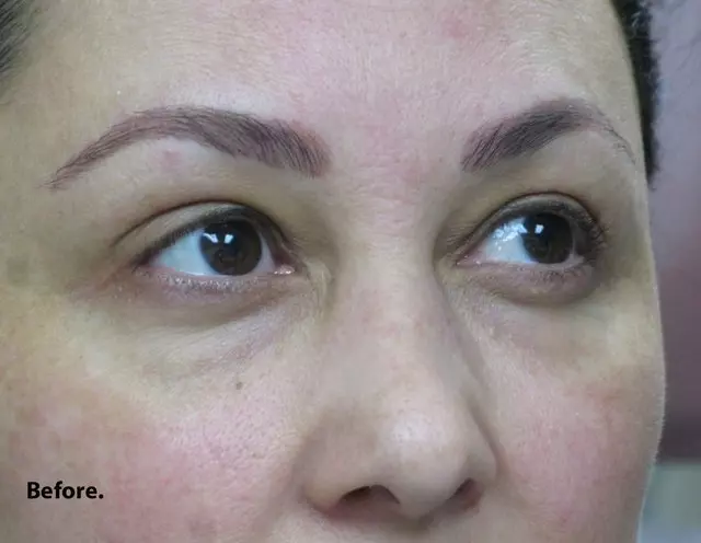 Aesthetic Laser Center