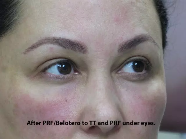 Aesthetic Laser Center