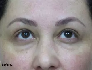 Aesthetic Laser Center